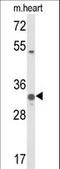 Coenzyme Q5, Methyltransferase antibody, LS-C166949, Lifespan Biosciences, Western Blot image 