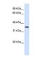 Thioredoxin-related transmembrane protein 2 antibody, NBP1-69586, Novus Biologicals, Western Blot image 