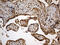 Dynein Axonemal Heavy Chain 6 antibody, LS-C796280, Lifespan Biosciences, Immunohistochemistry paraffin image 