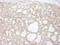 Tumor Protein P73 antibody, NB100-420, Novus Biologicals, Immunohistochemistry paraffin image 