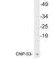 Natriuretic Peptide C antibody, LS-C199815, Lifespan Biosciences, Western Blot image 