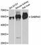 Gamma-Aminobutyric Acid Type A Receptor Alpha3 Subunit antibody, A11636, ABclonal Technology, Western Blot image 