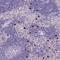 Tryptase Delta 1 antibody, PA5-62007, Invitrogen Antibodies, Immunohistochemistry paraffin image 