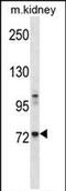 Tyrosine-protein kinase Tec antibody, PA5-71912, Invitrogen Antibodies, Western Blot image 