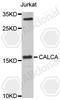 Calcitonin Related Polypeptide Alpha antibody, A5542, ABclonal Technology, Western Blot image 