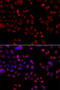 Solute Carrier Family 22 Member 11 antibody, 23-204, ProSci, Immunofluorescence image 