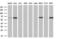 Fyn Related Src Family Tyrosine Kinase antibody, TA500629, Origene, Western Blot image 