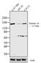 Kinesin Family Member 5A antibody, PA1-642, Invitrogen Antibodies, Western Blot image 