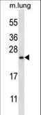 RHEB Like 1 antibody, LS-C162589, Lifespan Biosciences, Western Blot image 