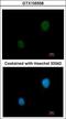 Protein Kinase CAMP-Dependent Type II Regulatory Subunit Beta antibody, GTX105558, GeneTex, Immunofluorescence image 