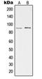 Protein Kinase CGMP-Dependent 2 antibody, orb214450, Biorbyt, Western Blot image 