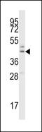 Beta-1,4-glucuronyltransferase 1 antibody, PA5-48528, Invitrogen Antibodies, Western Blot image 