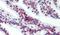 Solute Carrier Family 39 Member 6 antibody, PA5-34204, Invitrogen Antibodies, Immunohistochemistry paraffin image 