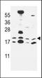 Canopy FGF Signaling Regulator 2 antibody, LS-C168894, Lifespan Biosciences, Western Blot image 