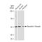 Tachykinin Receptor 1 antibody, GTX03228, GeneTex, Western Blot image 
