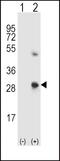 SPARC antibody, PA5-13703, Invitrogen Antibodies, Western Blot image 