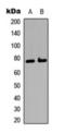 BMX Non-Receptor Tyrosine Kinase antibody, orb393226, Biorbyt, Western Blot image 