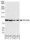 Inhibitor Of Nuclear Factor Kappa B Kinase Subunit Beta antibody, A301-827A, Bethyl Labs, Western Blot image 