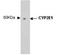 Cytochrome P450 Family 2 Subfamily E Member 1 antibody, NBP2-50203, Novus Biologicals, Western Blot image 