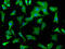 WD Repeat Domain 73 antibody, CSB-PA744047LA01HU, Cusabio, Immunofluorescence image 