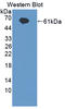 Interleukin 20 Receptor Subunit Alpha antibody, LS-C695358, Lifespan Biosciences, Western Blot image 