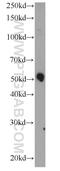 Polypeptide N-Acetylgalactosaminyltransferase Like 5 antibody, 17131-1-AP, Proteintech Group, Western Blot image 