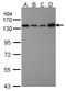 Squamous cell carcinoma antigen recognized by T-cells 3 antibody, NBP1-31487, Novus Biologicals, Western Blot image 