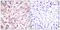 ETS Proto-Oncogene 1, Transcription Factor antibody, LS-C198939, Lifespan Biosciences, Immunohistochemistry paraffin image 