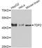 Tyrosyl-DNA Phosphodiesterase 2 antibody, A11617, ABclonal Technology, Western Blot image 