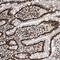 Nucleolin antibody, NBP1-88271, Novus Biologicals, Immunohistochemistry paraffin image 