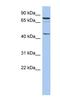 Ring Finger Protein 169 antibody, NBP1-55084, Novus Biologicals, Western Blot image 