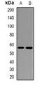 Interleukin 17 Receptor B antibody, orb382668, Biorbyt, Western Blot image 