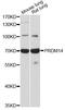 PR domain zinc finger protein 14 antibody, LS-C748696, Lifespan Biosciences, Western Blot image 