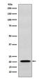 RAP1B, Member Of RAS Oncogene Family antibody, M01848, Boster Biological Technology, Western Blot image 