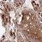 C2 Calcium Dependent Domain Containing 5 antibody, HPA046194, Atlas Antibodies, Immunohistochemistry frozen image 