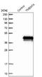 Transmembrane Protein 74 antibody, NBP1-83546, Novus Biologicals, Western Blot image 