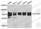 Eukaryotic Translation Initiation Factor 2 Alpha Kinase 2 antibody, A5578, ABclonal Technology, Western Blot image 