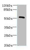 Zinc Finger Protein 410 antibody, A63888-100, Epigentek, Western Blot image 