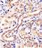 Potassium Channel Tetramerization Domain Containing 11 antibody, M10796, Boster Biological Technology, Immunohistochemistry paraffin image 