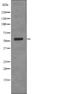 Carcinoembryonic Antigen Related Cell Adhesion Molecule 1 antibody, abx149185, Abbexa, Western Blot image 