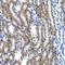 Zinc Finger AN1-Type Containing 3 antibody, LS-C349172, Lifespan Biosciences, Immunohistochemistry paraffin image 