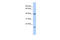 SLAIN Motif Family Member 1 antibody, 26-675, ProSci, Western Blot image 