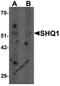 SHQ1, H/ACA Ribonucleoprotein Assembly Factor antibody, 7029, ProSci, Western Blot image 