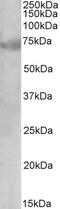 Pim-2 Proto-Oncogene, Serine/Threonine Kinase antibody, 43-335, ProSci, Western Blot image 