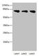 Acyl-CoA Synthetase Short Chain Family Member 2 antibody, LS-C675356, Lifespan Biosciences, Western Blot image 