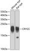 Crystallin Gamma S antibody, GTX32540, GeneTex, Western Blot image 