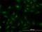 SGT1 Homolog, MIS12 Kinetochore Complex Assembly Cochaperone antibody, H00010910-M03, Novus Biologicals, Immunofluorescence image 