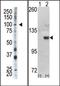 Hexokinase 1 antibody, AP15128PU-N, Origene, Western Blot image 