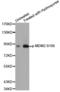 MDM2 Proto-Oncogene antibody, abx000344, Abbexa, Western Blot image 