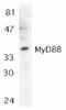 Myeloid differentiation primary response protein MyD88 antibody, ADI-CSA-510-E, Enzo Life Sciences, Western Blot image 